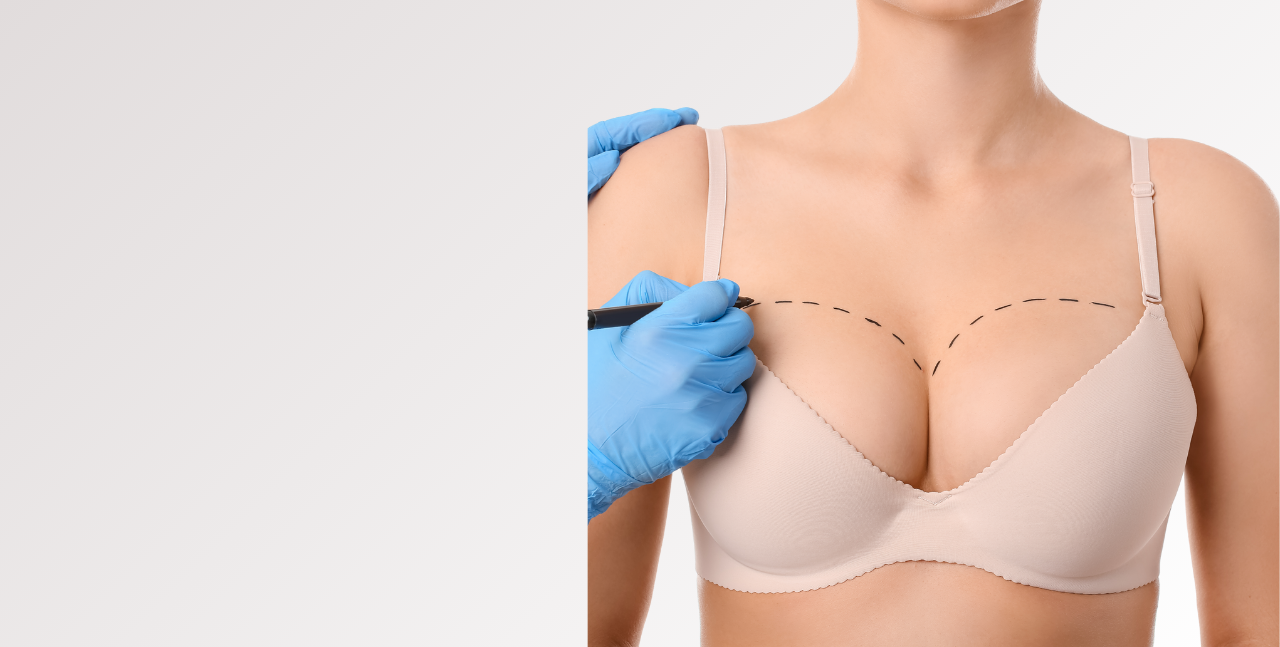 Breast Augmentation