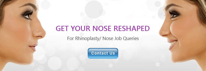 Rhinoplasty